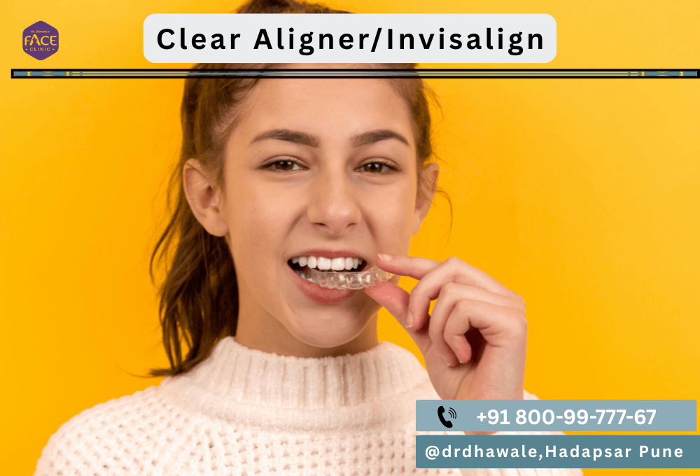 Dr Dhawale Pune Invisalign, Orthodonticc